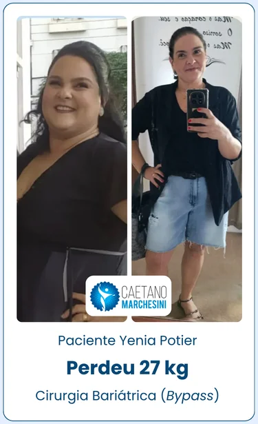 Paciente Yenia Potier