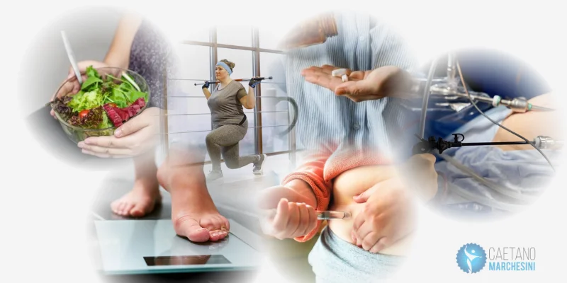 O tratamento da obesidade mudou muito nos últimos anos