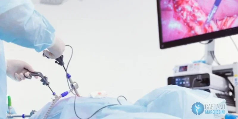 Como funciona a cirurgia bariátrica por videolaparoscopia
