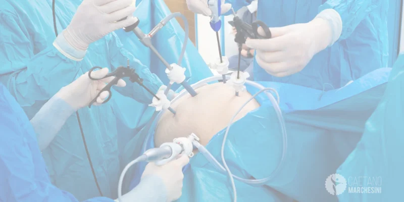 O que é cirurgia bariátrica